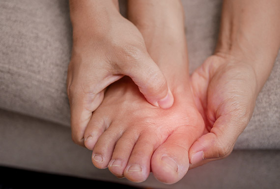 Bunions - Triangle Physiotherapy